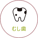 むし歯
