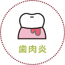 歯肉炎
