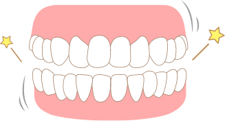 カチカチタイプイラスト