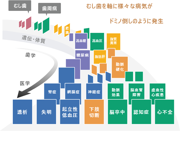 むし歯を軸に様々な病気がドミノ倒しのように発生