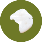 【詰め物】セラミックインレー