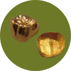 【被せ物】ゴールド