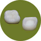 【被せ物】プレミアム オールセラミック