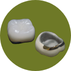 【被せ物】ホワイトクラウン（金属＋セラミック）