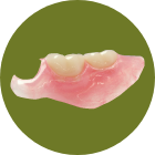 ノンクラスプデンチャー