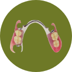 ノンクラスプ（金属フレーム）