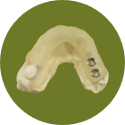 サージカルガイド（シミュレーション診断含む）