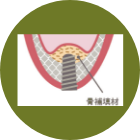 ソケットリフト